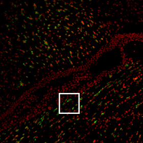 stellaris rna fish mouse brain plp1 zoom in