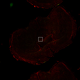 stellaris rna fish mouse brain plp1 zoomed out